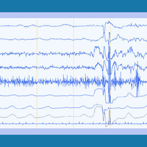 Polygraph Test